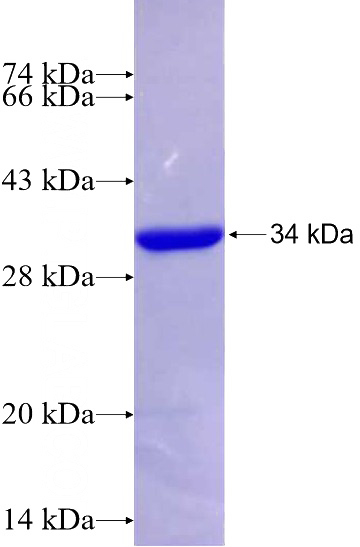 Recombinant Human GPR161 SDS-PAGE