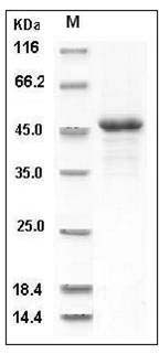 Human ILKAP Protein (His Tag) SDS-PAGE