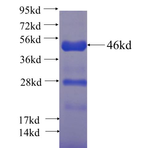 Recombinant human PTP4A1 SDS-PAGE