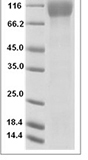 Human PDGFRB/CD140b Protein 15501