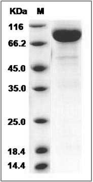 Rat IL13RA2 / IL13R Protein (Fc Tag) SDS-PAGE