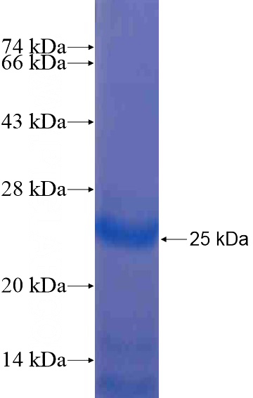Recombinant Human C2orf24 SDS-PAGE