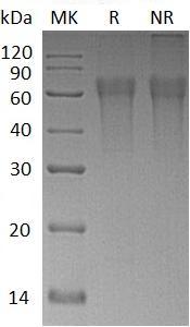 Human CD300LG/CLM9/TREM4/UNQ422/PRO846 (His tag) recombinant protein
