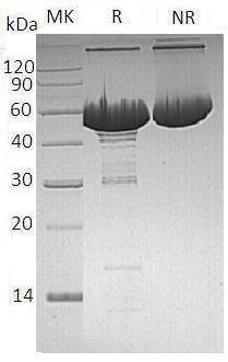 Human NAMPT/PBEF/PBEF1 (His tag) recombinant protein