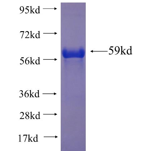 Recombinant human CPNE3 SDS-PAGE