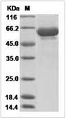 Influenza A H6N2 (A/chicken/Guangdong/C273/2011) Hemagglutinin / HA Protein (His Tag)