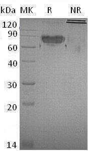 Mouse Icam2/Icam-2 (Fc tag) recombinant protein