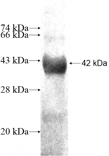 Recombinant Human TDRD7 SDS-PAGE