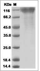 Ebola virus EBOV (subtype Zaire, strain H.sapiens-wt/GIN/2014/Kissidougou-C15) GP1 / Glycoprotein Protein (His Tag)