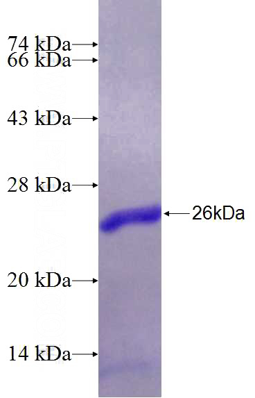 Recombinant Human PRR11 SDS-PAGE