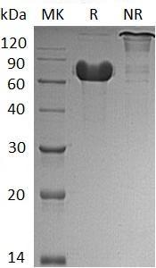 Human GOLM1/C9orf155/GOLPH2 (His tag) recombinant protein