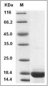 Cynomolgus CCL21 / 6Ckine Protein SDS-PAGE