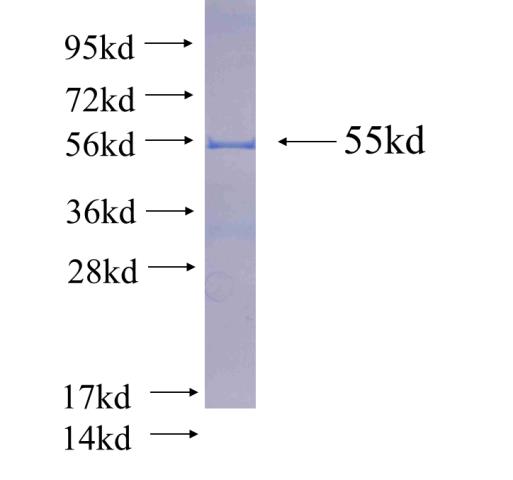 Recombinant human ANP32B(Full length) SDS-PAGE