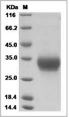 RAET1L protein SDS-PAGE