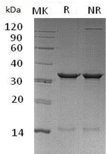 Human CDC73/C1orf28/HRPT2 (His tag) recombinant protein