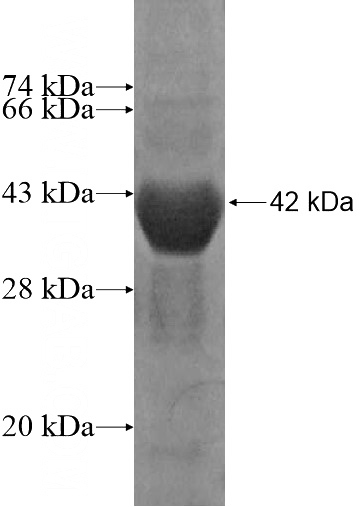 Recombinant Human TKTL2 SDS-PAGE