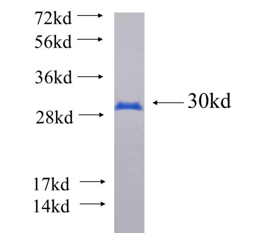 Recombinant human HES6 SDS-PAGE